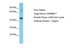 PRAMEF7 Rabbit anti-Human, Polyclonal, Novus Biologicals 0.1 mL | Buy Online | Novus Biologicals | Fisher Scientific
